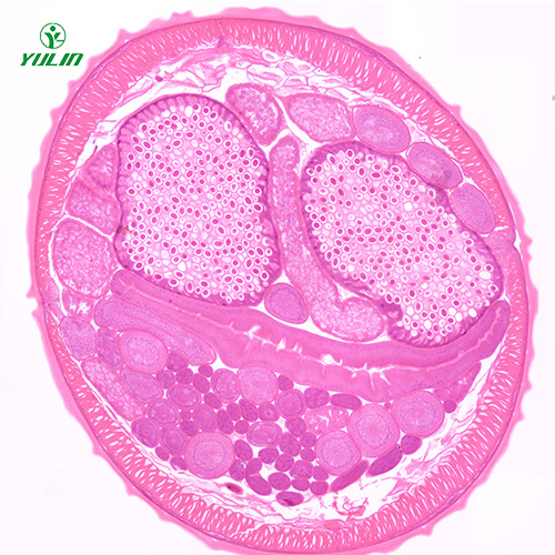 海南蛔虫（雌）