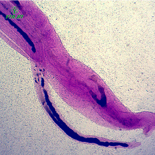 海南日本血吸虫雌雄合抱装片