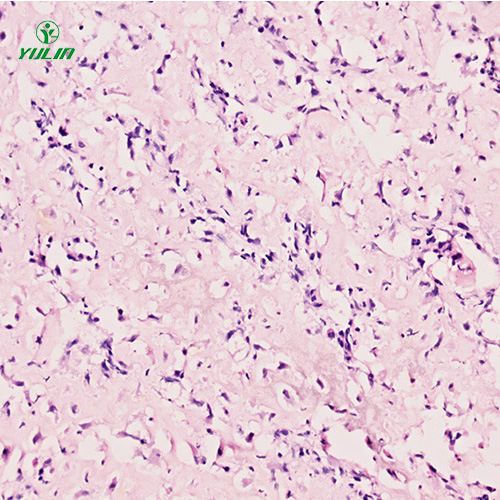 海南人肌肉骨骼系统疾病标本片