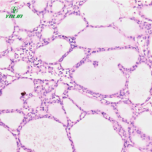海南人内分泌系统疾病标本片