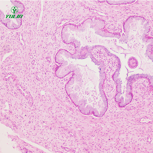海南人泌尿生殖系统疾病标本片