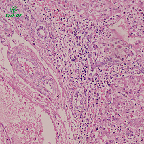 海南人消化系统疾病标本片