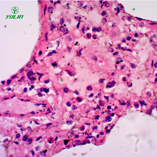 海南人呼吸系统疾病标本片