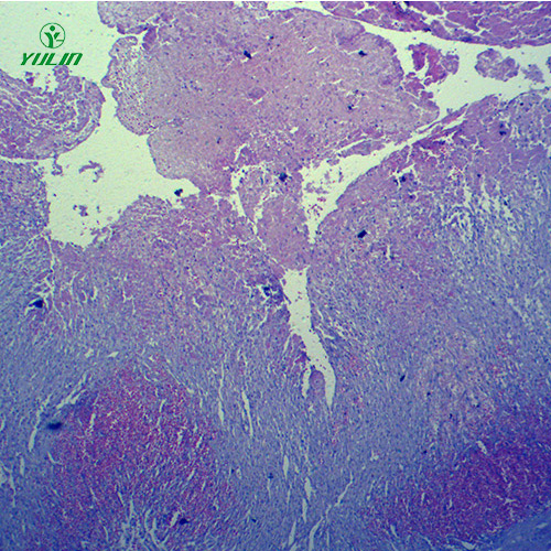 海南人体局部血液循环障碍病理玻片