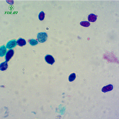 海南酵母菌生物切片