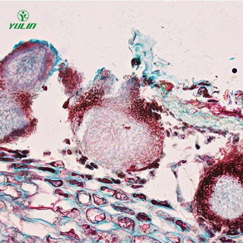 海南水果病害标本片
