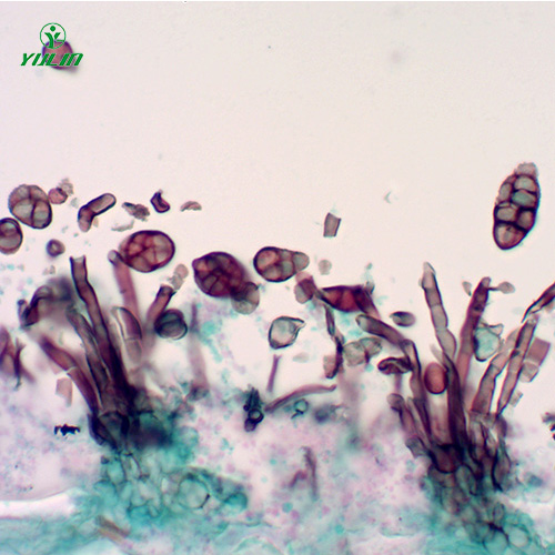 海南茄科植物病害玻片