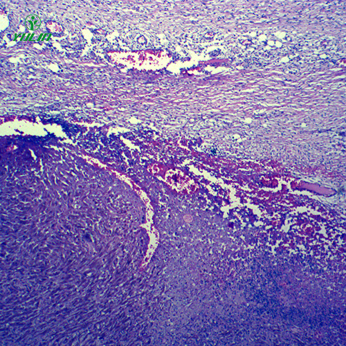 海南动物病理学肿瘤类切片