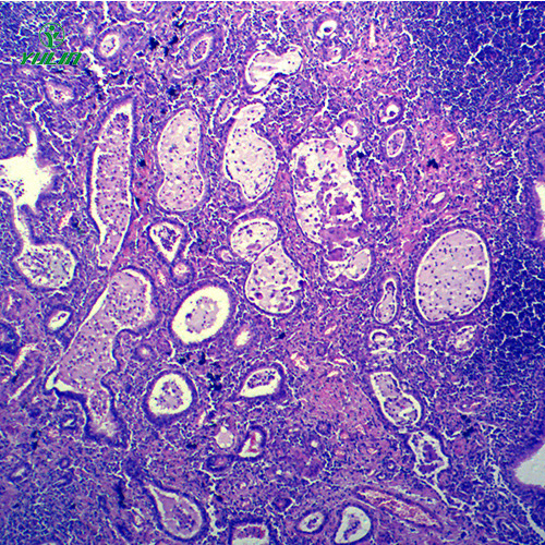 海南炎症病理玻片